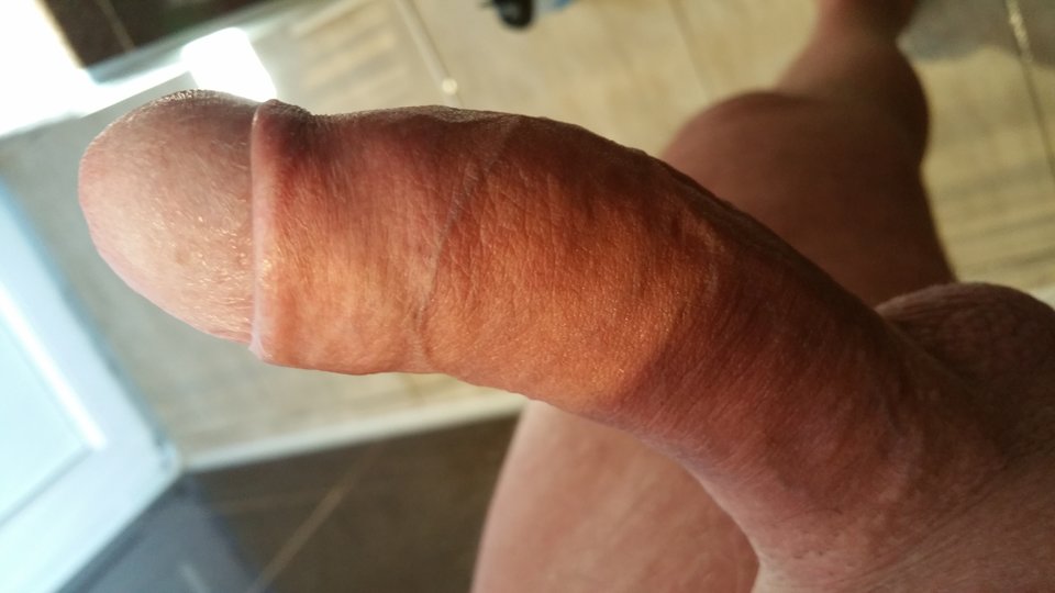 000015877888.Jpeg - abcpara