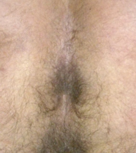 dziura.jpg - chrzanowlodziarz34