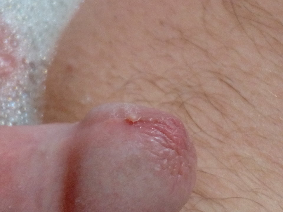 1551288765980871569032.jpg - matuzalem000