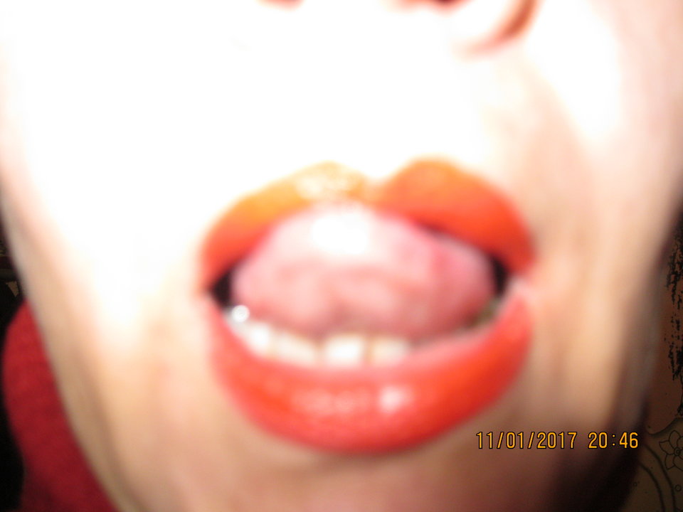 IMG_0539.JPG - YETIBYDG