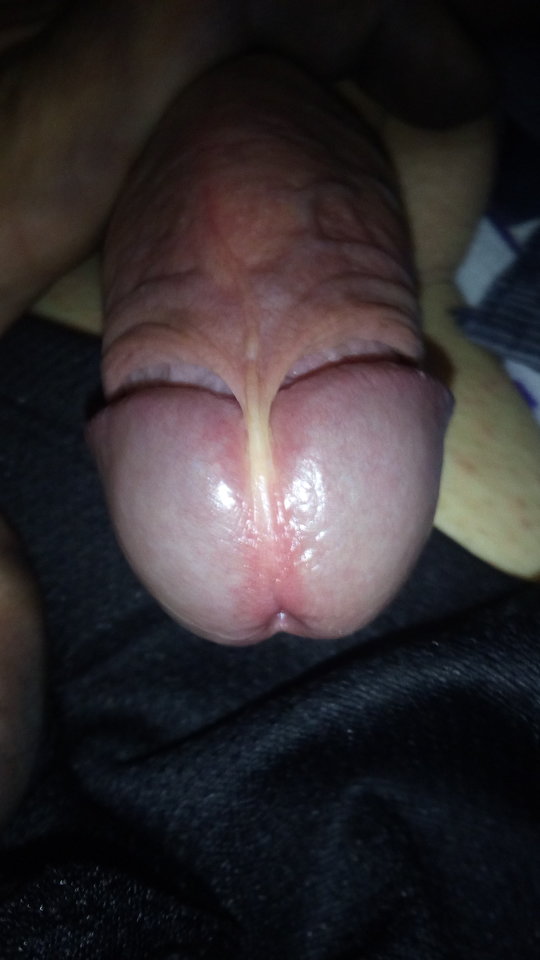 IMG-20180818-WA0049.jpeg - EdwardKrol