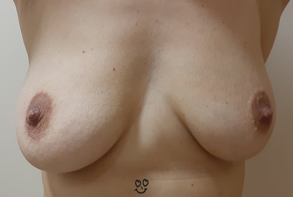 Zalej mi je - aga124