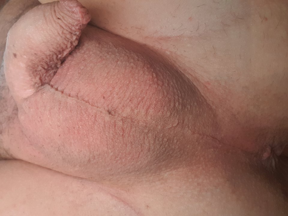 ogolone jajka - Freeman71