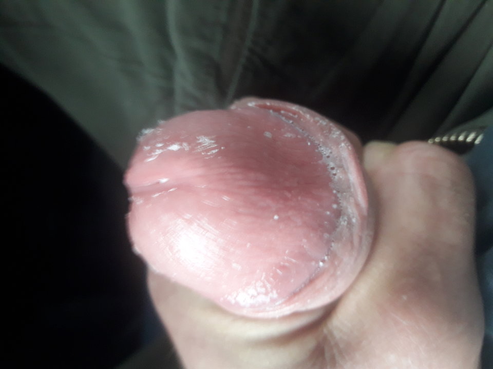 TAKA ŚLISKA SYTUACJA - flilipo