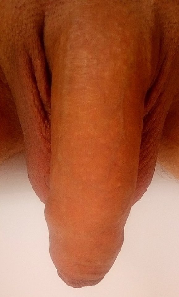 dickie2.jpg - terazjuz