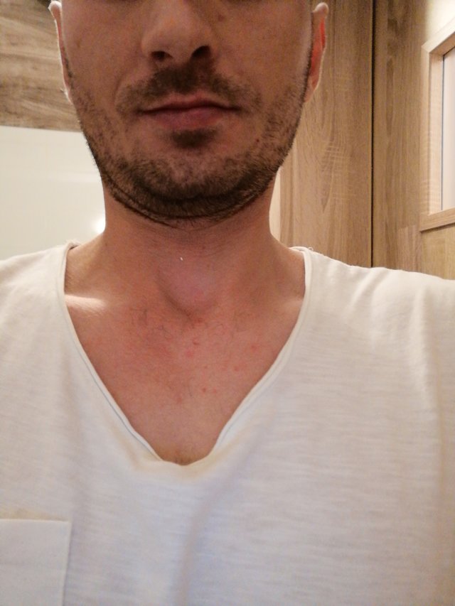 Pawczus