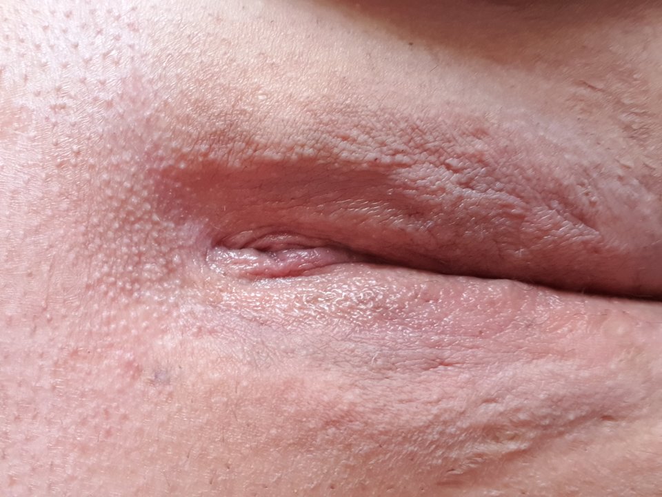 Po depilacji 2.jpg - Dracona