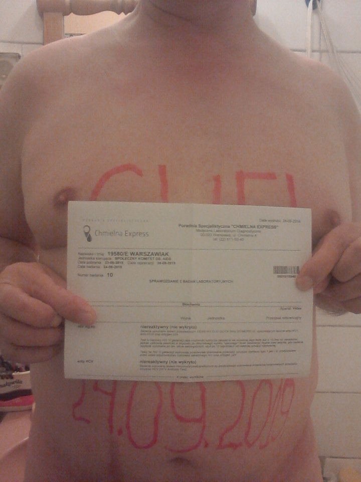 P cwelik robi zdjęcie wyników badań HIV 24.09.2019 g.21.25.jpg - Wawa48