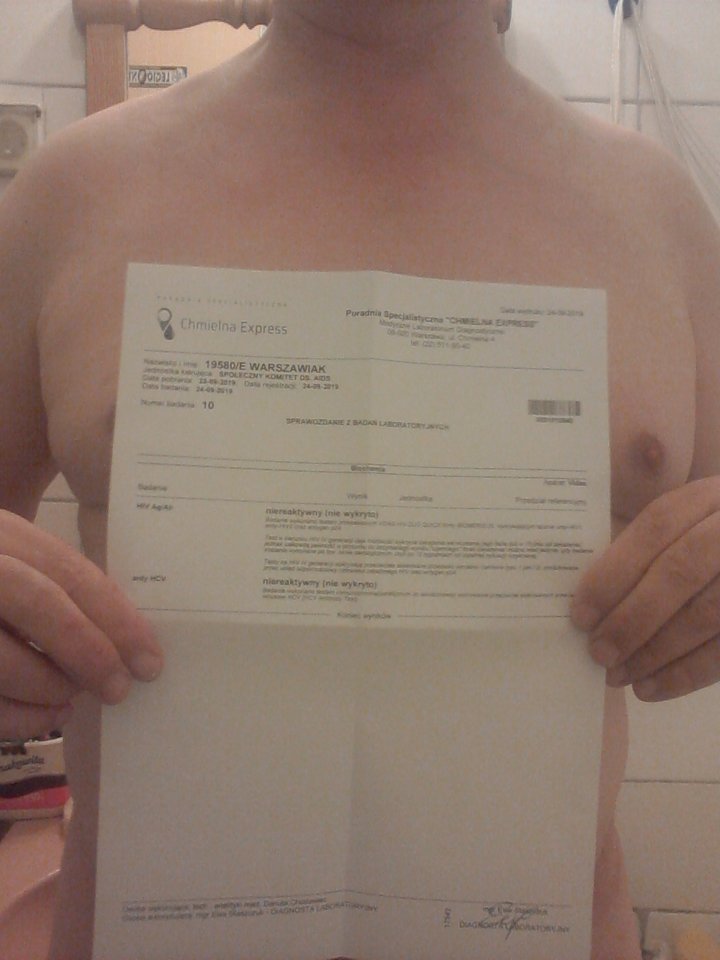 P cwelik zdjęcie z wynikami badań HIV 24.09.2019 g.21.25.jpg - Wawa48