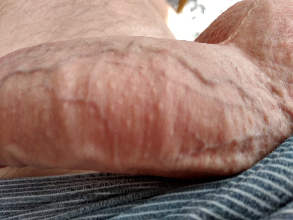 15716540365029101101177893719995.jpg - twoeyes