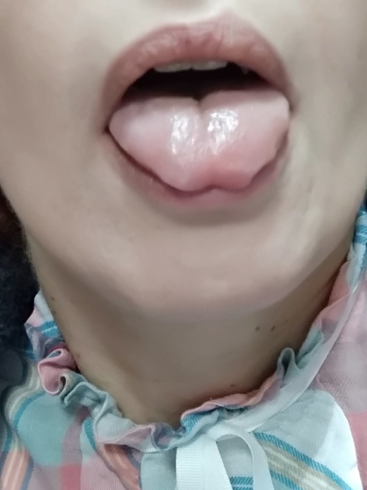 part000001(7).jpg - KKKS7072