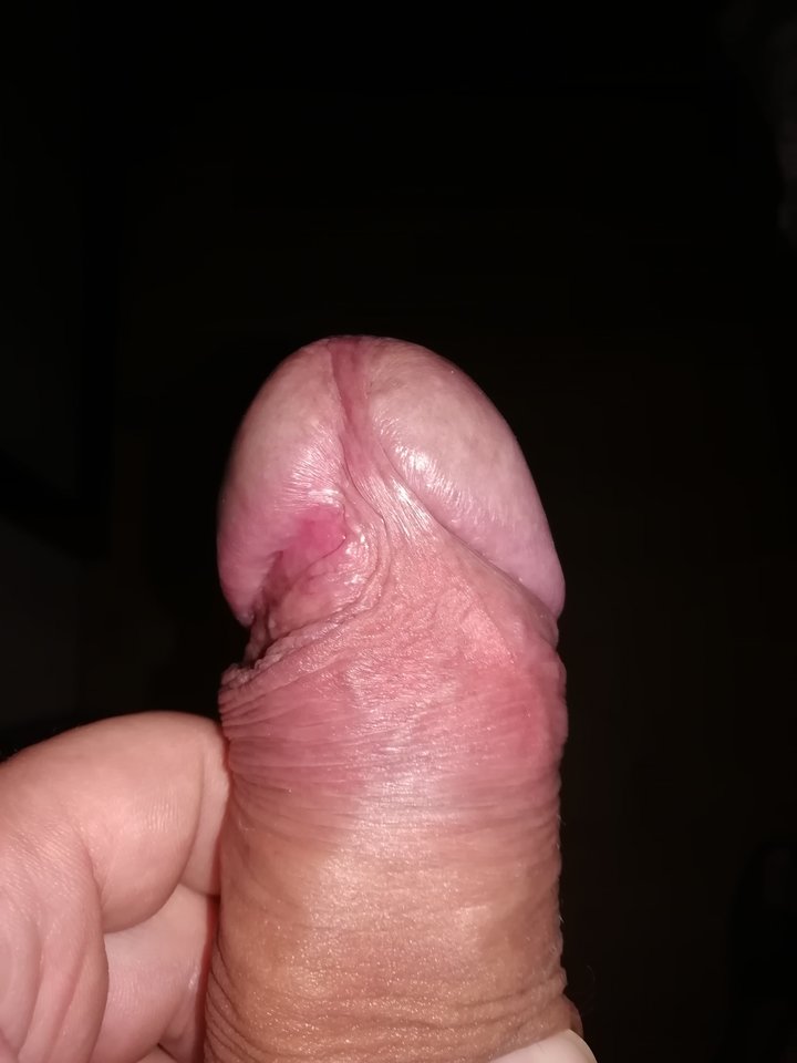 IMG_20191111_105614.jpg - wirus101