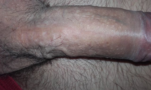 Mik78