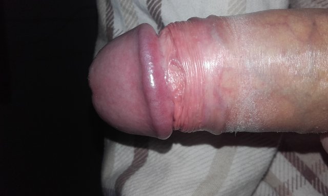 Mik78