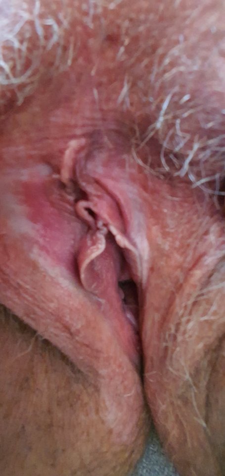Nakedpussy - nakedgirl