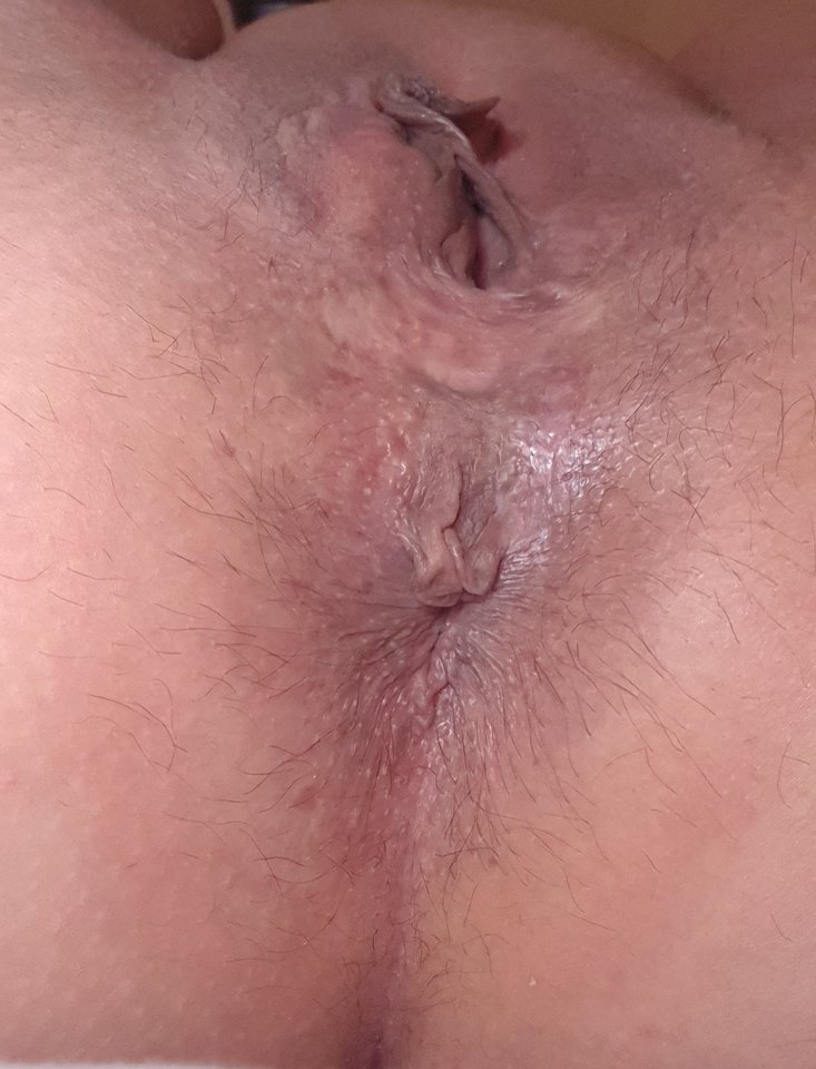 20240305_205847.jpg - 86Dupcia