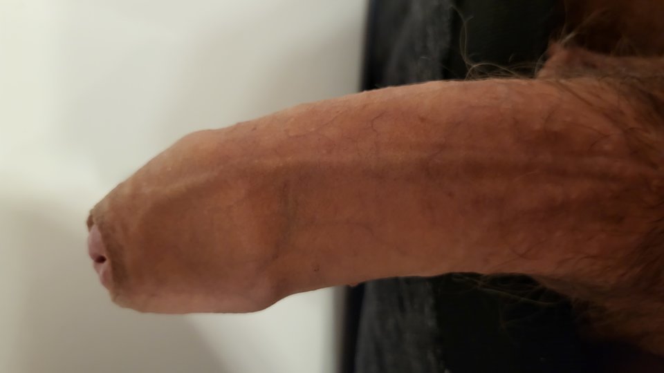 1000024125.jpg - Picc