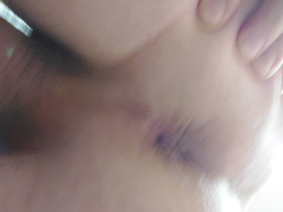 1000010239.jpg - Forsst