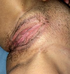 No nic trzeba troszkę podgolic 😊