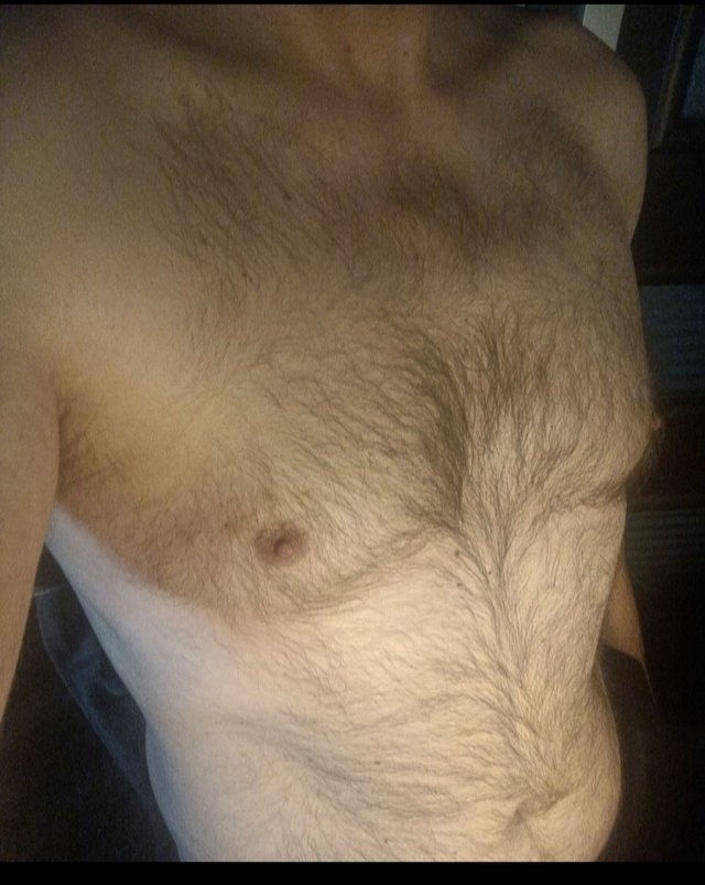 Skinnyfan