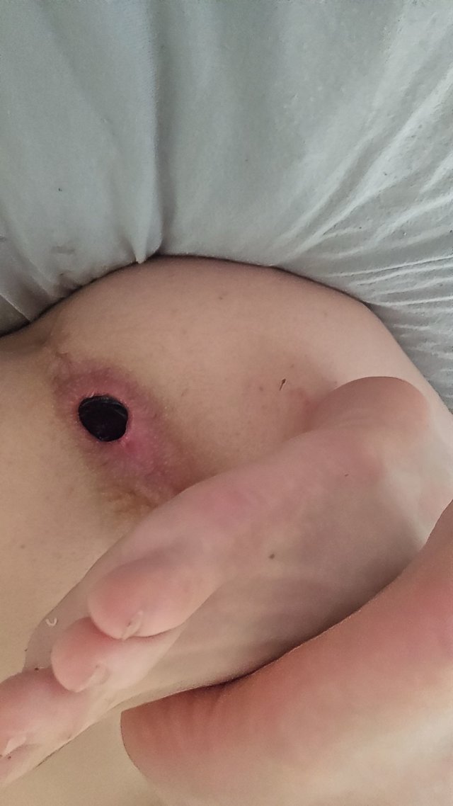 Pupa00