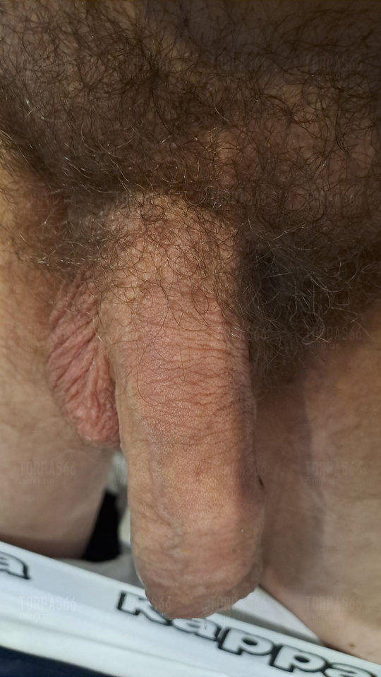 200108.jpg - torpas66