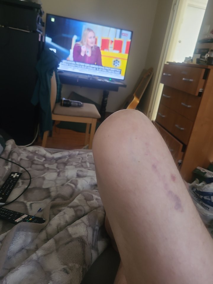 IMG_20260314_110026.jpg - podejmezboczona18